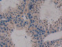 DAB staining on fromalin fixed paraffin- embedded testis tissue)