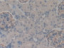 DAB staining on IHC-P; Samples: Rat Kidney Tissue; Primary Ab: 10µg/ml Rabbit Anti-Rat PCX Antibody Second Ab: 2µg/mL HRP-Linked Caprine Anti-Rabbit IgG Polyclonal Antibody