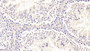 DAB staining on IHC-P; Samples: Mouse Testis Tissue; Primary Ab: 20μg/ml Rabbit Anti-Mouse FOXO1 Antibody Second Ab: 2µg/mL HRP-Linked Caprine Anti-Rabbit IgG Polyclonal Antibody