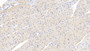 DAB staining on IHC-P; Samples: Human Cardiac Muscle Tissue;  Primary Ab: 20μg/ml Rabbit Anti-Human FOXO3 Antibody Second Ab: 2µg/mL HRP-Linked Caprine Anti-Rabbit IgG Polyclonal Antibody 