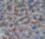 Epidermal Growth Factor Receptor (Egfr) Polyclonal Antibody, Cat#CAU27215