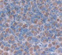 Mucin 5 Subtype Ac (Muc5Ac) Polyclonal Antibody, Cat#CAU27222