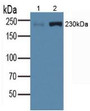 Western Blot; Sample: Lane1: Porcine Skeletal Muscle Tissue; Lane2: Porcine Heart Tissue.