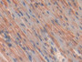 DAB staining on fromalin fixed paraffin-embedded Liver tissue)