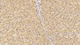 DAB staining on IHC-P; Samples: Human Liver Tissue; Primary Ab: 30µg/ml Rabbit Anti-Human FGF23 Antibody Second Ab: 2µg/mL HRP-Linked Caprine Anti-Rabbit IgG Polyclonal Antibody