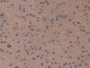 DAB staining on IHC-P; Samples: Mouse Cerebrum Tissue;  Primary Ab: 10µg/ml Rabbit Anti-Mouse MT3 An