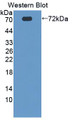 Western Blot; Sample: Recombinant protein.