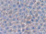 DAB staining on IHC-P; Samples: Mouse Liver Tissue; Primary Ab: 30µg/ml Rabbit Anti-Mouse PROZ Antibody Second Ab: 2µg/mL HRP-Linked Caprine Anti-Rabbit IgG Polyclonal Antibody