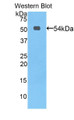 Western Blot; Sample: Recombinant protein.