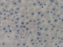 DAB staining on IHC-P; Samples: Rat Liver Tissue; Primary Ab: 10µg/ml Rabbit Anti-Rat C7 Antibody Second Ab: 2µg/mL HRP-Linked Caprine Anti-Rabbit IgG Polyclonal Antibody