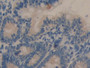 DAB staining on IHC-P; Samples: Rat Intestine Tissue.