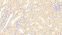 DAB staining on IHC-P; Samples: Human Kidney Tissue;  Primary Ab: 20μg/ml Rabbit Anti-Human C7 Antibody Second Ab: 2µg/mL HRP-Linked Caprine Anti-Rabbit IgG Polyclonal Antibody 