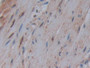 DAB staining on IHC-P; Samples: Human Rectum Tissue;  Primary Ab: 10µg/ml Rabbit Anti-Human PTGS1 An