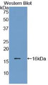 Western Blot; Sample: Recombinant protein.