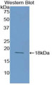 Western Blot; Sample: Recombinant protein.