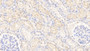 DAB staining on IHC-P; Samples: Bovine Kidney Tissue;  Primary Ab: 20μg/ml Rabbit Anti-Bovine TTR Antibody Second Ab: 2µg/mL HRP-Linked Caprine Anti-Rabbit IgG Polyclonal Antibody 