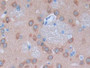 DAB staining on fromalin fixed paraffin-embedded Spleen tissue)