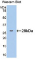 Western Blot; Sample: Recombinant protein.