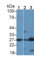 Western Blot; Sample: Lane1: Human Urine; Lane2: Mouse Colon lysate; Lane3: Porcine Colon lysate; Primary Ab: 2μg/ml Rabbit Anti-Human PGD2S Antibody; Second Ab: 0.2µg/mL HRP-Linked Caprine Anti-Rabbit IgG Polyclonal Antibody;