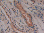 DAB staining on IHC-P; Samples: Human Kidney Tissue; Primary Ab: 10µg/ml Rabbit Anti-Human PGD2S Antibody Second Ab: 2µg/mL HRP-Linked Caprine Anti-Rabbit IgG Polyclonal Antibody