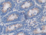 DAB staining on IHC-P; Samples: Rat Large Intestine Tissue