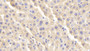 DAB staining on IHC-P; Samples: Rat Liver Tissue; Primary Ab: 20μg/ml Rabbit Anti-Rat bACE1 Antibody Second Ab: 2µg/mL HRP-Linked Caprine Anti-Rabbit IgG Polyclonal Antibody