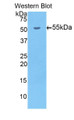 Western Blot; Sample: Recombinant protein.