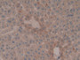 DAB staining on IHC-P; Samples: Rat Liver Tissue;  Primary Ab: 10µg/ml Rabbit Anti-Rat ATP1b3 Antibo
