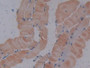 DAB staining on IHC-P; Samples: Mouse Skeletal muscle Tissue;  Primary Ab: 10µg/ml Rabbit Anti-Mouse