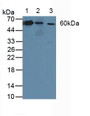 Western Blot; Sample: Lane1: Human Lung Tissue; Lane2: Human A-431 Cells; Lane3: Rat Skin Tissue.