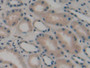 DAB staining on IHC-P; Samples: Human Kidney Tissue; Primary Ab: 5µg/ml Rabbit Anti-Human ATP1b3 Antibody Second Ab: 2µg/mL HRP-Linked Caprine Anti-Rabbit IgG Polyclonal Antibody