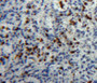 DAB staining on fromalin fixed paraffin-embedded spleen tissue)