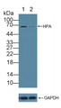 Knockout Varification: ; Lane 1: Wild-type HepG2 cell lysate; ; Lane 2: HPA knockout HepG2 cell lysate; ; Predicted MW: 43,53,55,61kd ; Observed MW: 68kd; Primary Ab: 1µg/ml Rabbit Anti-Human HPA Antibody; Second Ab: 0.2µg/mL HRP-Linked Caprine Anti-Rabbit IgG Polyclonal Antibody;