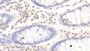 DAB staining on IHC-P; Samples: Human Colon Tissue; Primary Ab: 20μg/ml Rabbit Anti-Human HPA Antibody Second Ab: 2µg/mL HRP-Linked Caprine Anti-Rabbit IgG Polyclonal Antibody