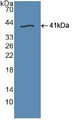 Western Blot; Sample: Recombinant TLR9, Human.