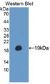 Western Blot; Sample: Recombinant protein.