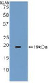 Western Blot; Sample: Recombinant dSIP, Human.