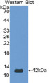 Western Blot; Sample: Recombinant protein.