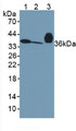 Western Blot; Sample: Lane1: Mouse Serum; Lane2: Mouse Liver Tissue; Lane3: Rat Serum.