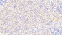 DAB staining on IHC-P; Samples: Human Kidney Tissue; Primary Ab: 20μg/ml Rabbit Anti-Human APOE Antibody Second Ab: 2µg/mL HRP-Linked Caprine Anti-Rabbit IgG Polyclonal Antibody