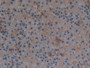 DAB staining on IHC-P; Samples: Rat Adrenal Gland Tissue.