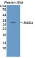 Western Blot; Sample: Recombinant protein.