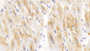 DAB staining on IHC-P; Samples: Human Cardiac Muscle Tissue; Primary Ab: 30µg/ml Rabbit Anti-Human DLAT Antibody Second Ab: 2µg/mL HRP-Linked Caprine Anti-Rabbit IgG Polyclonal Antibody