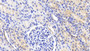 DAB staining on fromalin fixed paraffin-embedded Brain tissue)