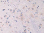 DAB staining on IHC-P; Samples: Rat Cerebrum Tissue;  Primary Ab: 20µg/ml Rabbit Anti-Rat NRP1 Antib