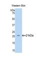 Western Blot; Sample: Recombinant protein.