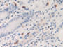 DAB staining on IHC-P; Samples: Human Stomach Tissue; Primary Ab: 20µg/ml Rabbit Anti-Human KLK6 Antibody Second Ab: 2µg/mL HRP-Linked Caprine Anti-Rabbit IgG Polyclonal Antibody