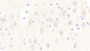 DAB staining on IHC-P; Samples: Human Cerebrum Tissue; Primary Ab: 20μg/ml Rabbit Anti-Human PCT Antibody Second Ab: 2µg/mL HRP-Linked Caprine Anti-Rabbit IgG Polyclonal Antibody