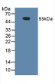 Western Blot; Sample: Human Urine.