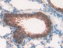 DAB staining on fromalin fixed paraffin- embedded lung tissue)